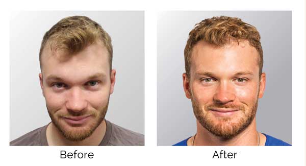 Danny-before