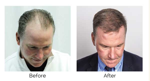 jim-before