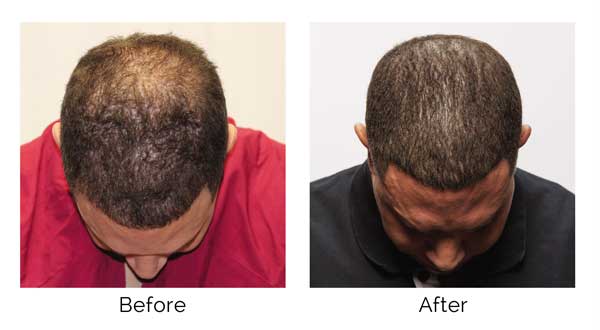 mike-before