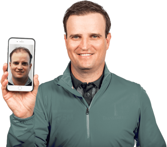 Zach Johnson RESTORE Hair Before and After