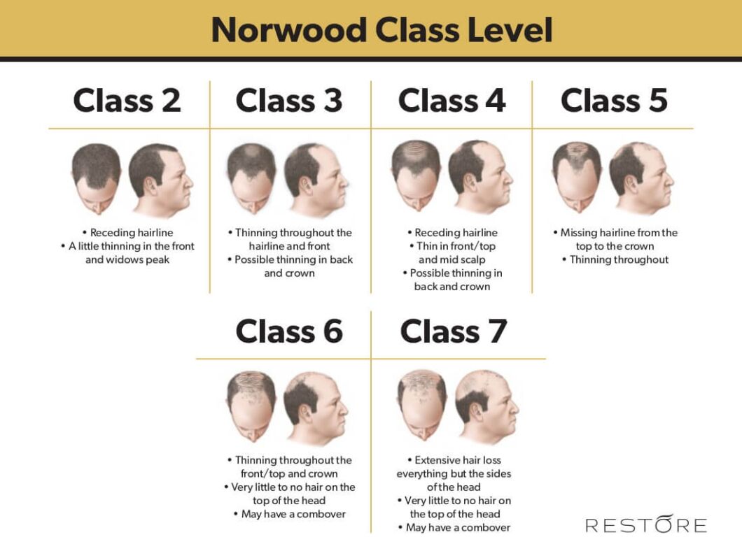 norwood-chart (1)