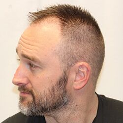 Client Daniel T. Progress Photos Day 5 Client Daniel T. Progress Photos Day 5