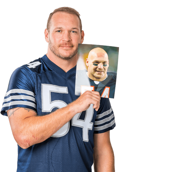  Brian Urlacher RESTORE Hair Results