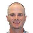 Kevin Streelman's Before Hair Transplant photo
