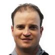 Zach Johnsons Before Hair Transplant photo