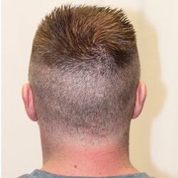 Client Daniel T. Progress Photos Day 5