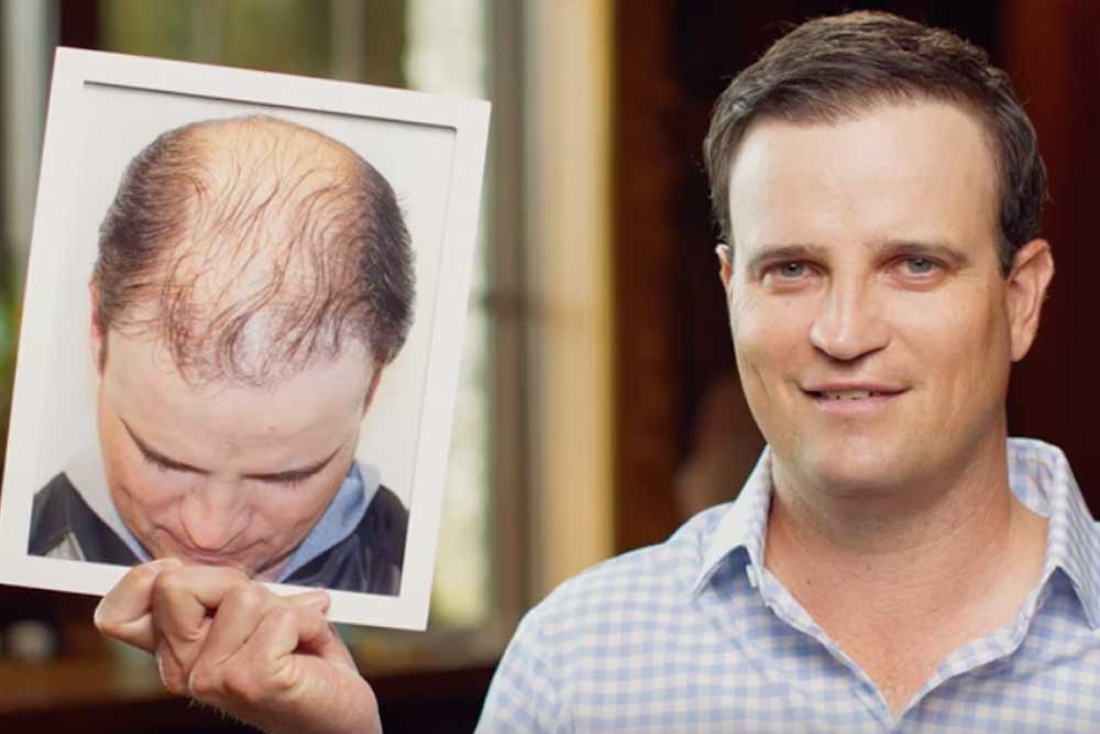 Restore hair cost video Restore hair cost video